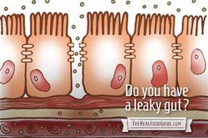 Do You Have A Leaky Gut